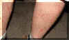 abrasions.jpg (39561 bytes)