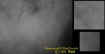 thickfoggyectomass.jpg (17548 bytes)